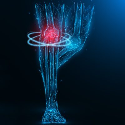 MSM-and-Its-Role-in-Joint-Health